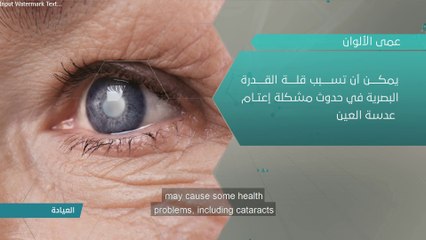عيوب الإبصار.. ما تأثيرها على الشخص المصاب؟