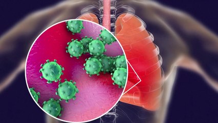 '신종 코로나' 사망 원인은?...폐 기능 상실과 2차 감염 / YTN