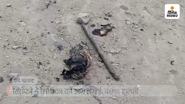 शादी से मना करने पर सिरफिरे ने कॉलेज शिक्षिका को सड़क पर पेट्रोल डालकर जलाया, हालत गंभीर