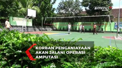 Siswa Korban Dugaan Penganiayaan Akan Jalani Operasi Amputasi