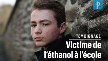 Brûlé en classe à l’éthanol : « Il y a eu une boule de feu et j’ai été projeté de ma chaise »