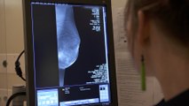 Cada día mueren en España unas 300 personas por cáncer