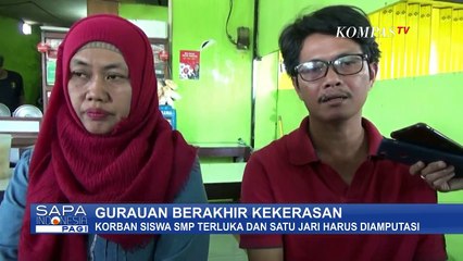 Satu Jari Siswa SMP harus Diamputasi, Akibat Perundungan di Malang