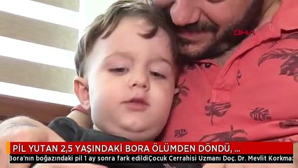 PİL YUTAN 2,5 YAŞINDAKİ BORA ÖLÜMDEN DÖNDÜ, UZMANLAR AİLELERİ UYARDI