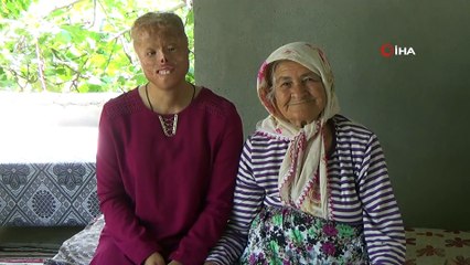 Tek isteği insanların ondan korkmaması... Leyla yeni 'yüz' bekliyor