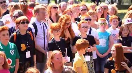 شاهد: الصُهب يحيون مهرجان "الحب الأحمر" في فرنسا لمكافحة التمييز ضدهم