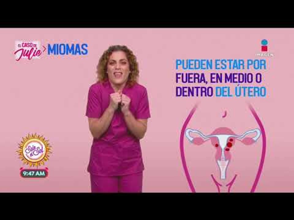 ¿Qué son los miomas uterinos? | Sale el Sol