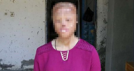 Bakan Koca'dan yüz nakli olmayı bekleyen Leyla'ya destek mesajı