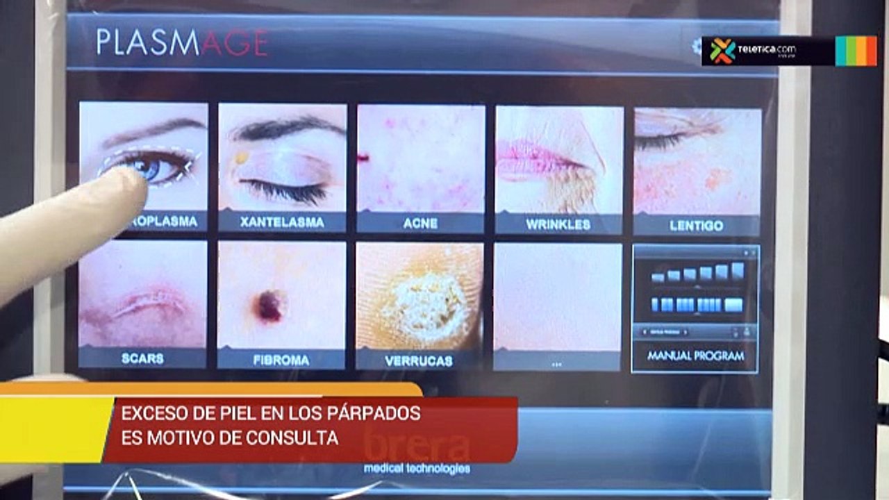 bd-exceso-de-piel-parpados-270819