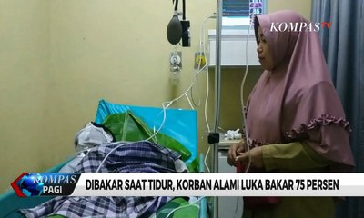 Dibakar Istri Saat Tidur, Suami Alami Luka Bakar 75%