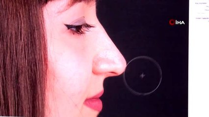 "Burun estetiğinde Türkiye'ye ilgi artıyor"