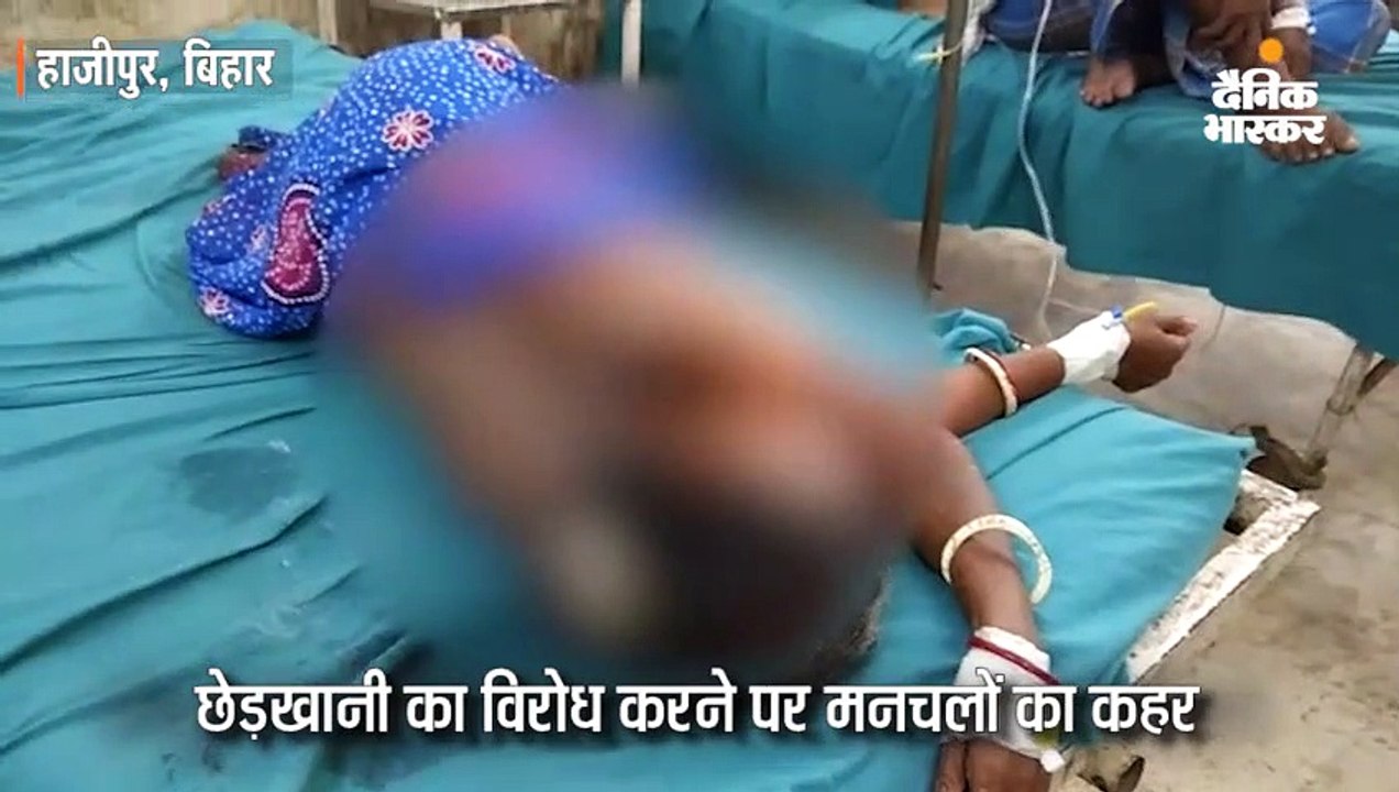 वैशाली में छेड़खानी का विरोध करने पर घर में घुसकर परिवार के 16 लोगों पर एसिड अटैक