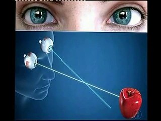 What is a Squint and how to treat it