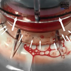 Don de plasma : les défaillances des machines Haemonetics