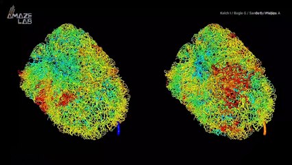 Tattoo Needle Particles Have Been Found in Human Lymph Nodes