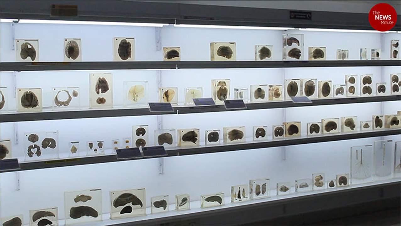 'It's rubbery, not gooey': What a trip to Bengaluru's brain museum taught us!