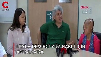 Leyla Demirci yüz nakli için Antalya'da