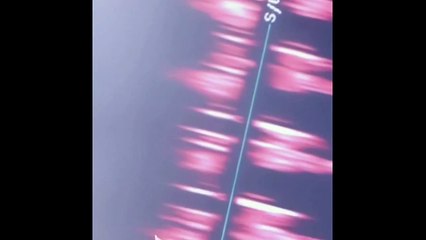 Toñi Moreno comparte el latido del corazón de su bebé