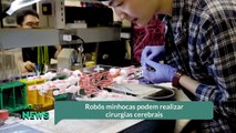 Robôs minhocas podem realizar cirurgias cerebrais