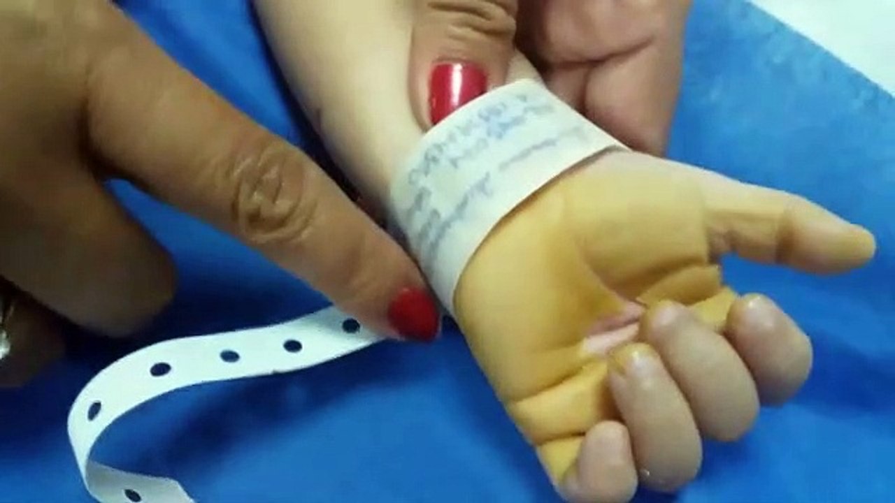 Menor de 1 año de edad resulto con quemaduras luego de que le cayera acido en su cuerpo