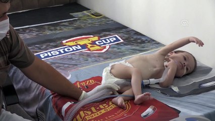 Minik Ayaz evindeki 'yoğun bakımla' hayata tutunuyor - MANİSA