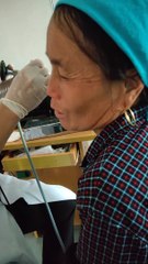 Leech Removed from Farmers Nose