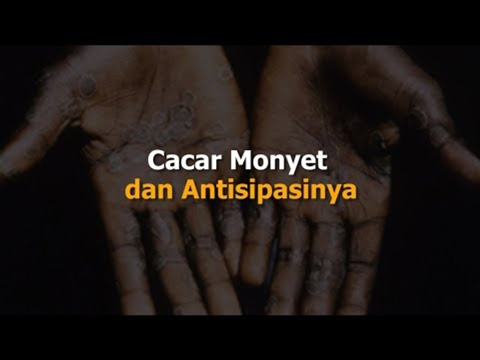 Cacar Monyet dan Antisipasinya