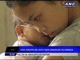 DOH grapples with new measles outbreak