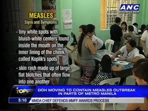 21 dead in Metro Manila from measles outbreak