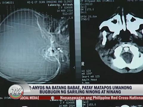 Toddler allegedly mauled to death by godparents