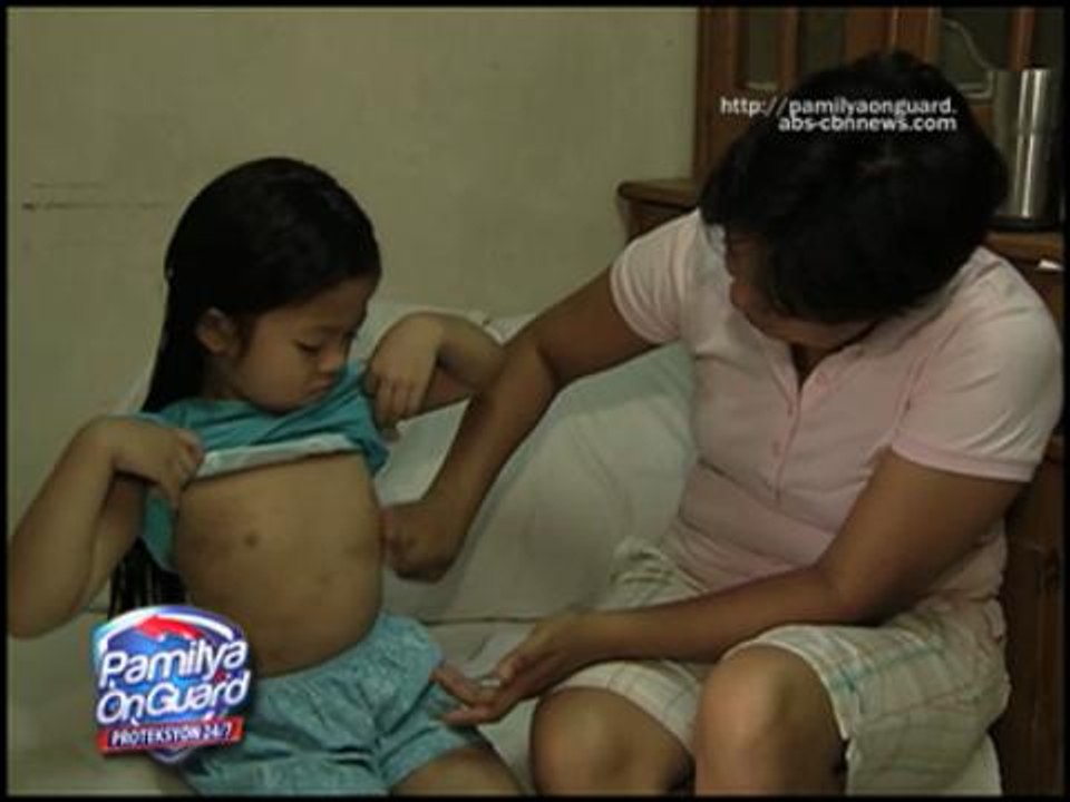 pamilyaonguard-HOW TO AVOID RASHES