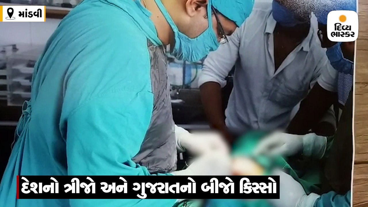 માંડવીમાં બે લિંગ સાથે જન્મ લેનાર બાળકનું ઓપરેશ...