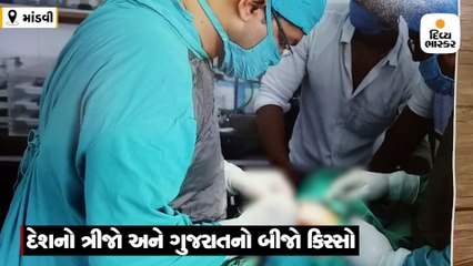 માંડવીમાં બે લિંગ સાથે જન્મ લેનાર બાળકનું ઓપરેશન કરી એક લિંગ અલગ કરાયું