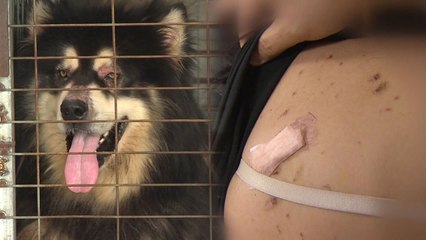 20대 여성 1m 크기 대형견에 물려 전치 3주 부상 / YTN