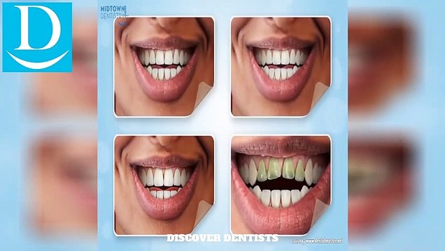 DISCOVER DENTISTS Veneers