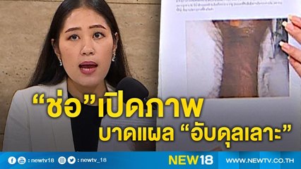 “ช่อ”เปิดภาพ บาดแผล“อับดุลเลาะ” | NEW18