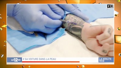 Technologie : se faire greffer une puce pour déverrouiller sa voiture