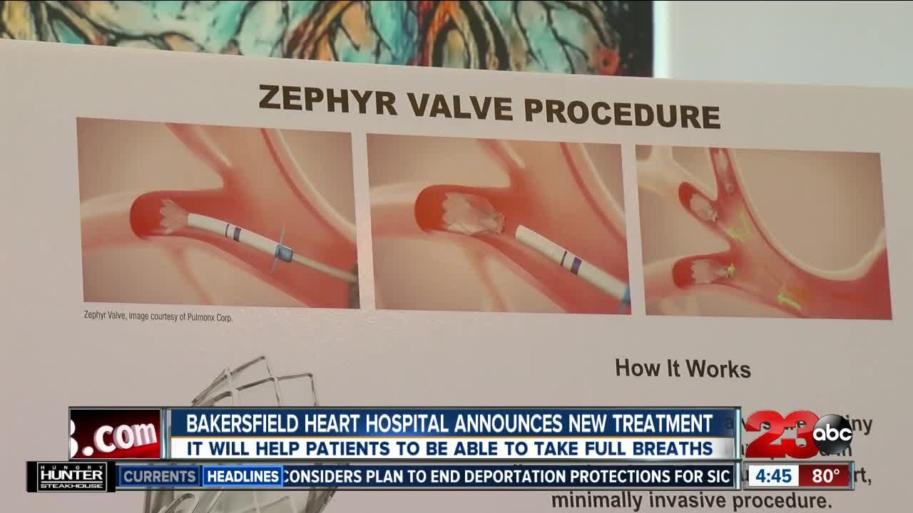 Bakersfield Heart Hospital announces new treatm...