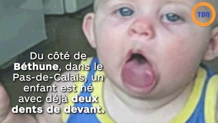 Rarissime ! À Béthune, un enfant né avec deux dents !