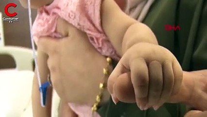 Mucize bebek Elvin, hayata tutundu