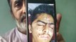 Kashmiri teenager dies of pellet, tear gas shell wounds | Oneindia Malayalam