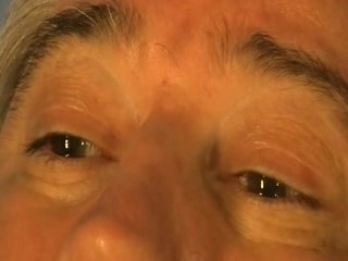 PERTE DE CONSCIENCE D'HENRI PAR LE KO VISUEL