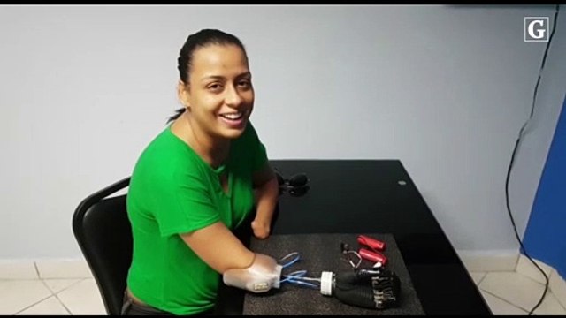 Após perder quatro membros, mulher tenta arrecadar R$ 245 mil para próteses