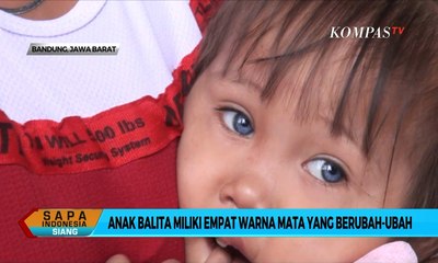 Balita ini Miliki 4 Warna Mata yang Berubah-Ubah