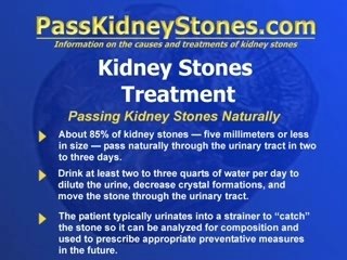 Passing Kidney Stones