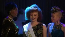 Le Malawi organise son premier concours de beauté pour les personnes atteintes d'albinisme