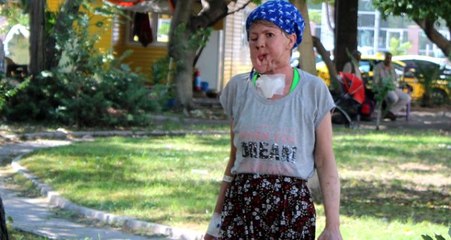 Çenesinde çıkan sivilce genç kadının hayatını kararttı!