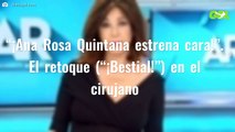 “¡Ana Rosa Quintana estrena cara!”. El retoque (“¡Bestial!”) en el cirujano