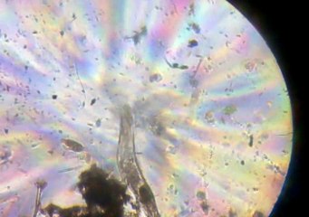 micro organisme inconnu