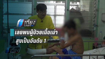 สสจ.เลยพบผู้ป่วยเนื้อเน่าสูงเป็นอันดับ 1 ติดต่อ 3 ปีซ้อน | เที่ยงทันข่าว